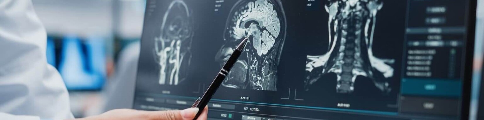 Eine Person schaut sich medizinische Ergebnisse auf einem Bildschirm an